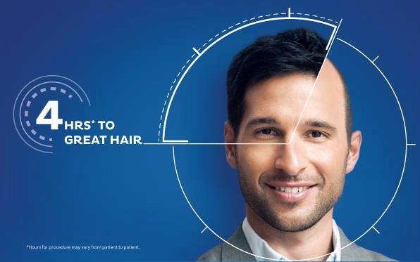 Hair Patch in Chennai, Prices, Men & Women Hair Patches